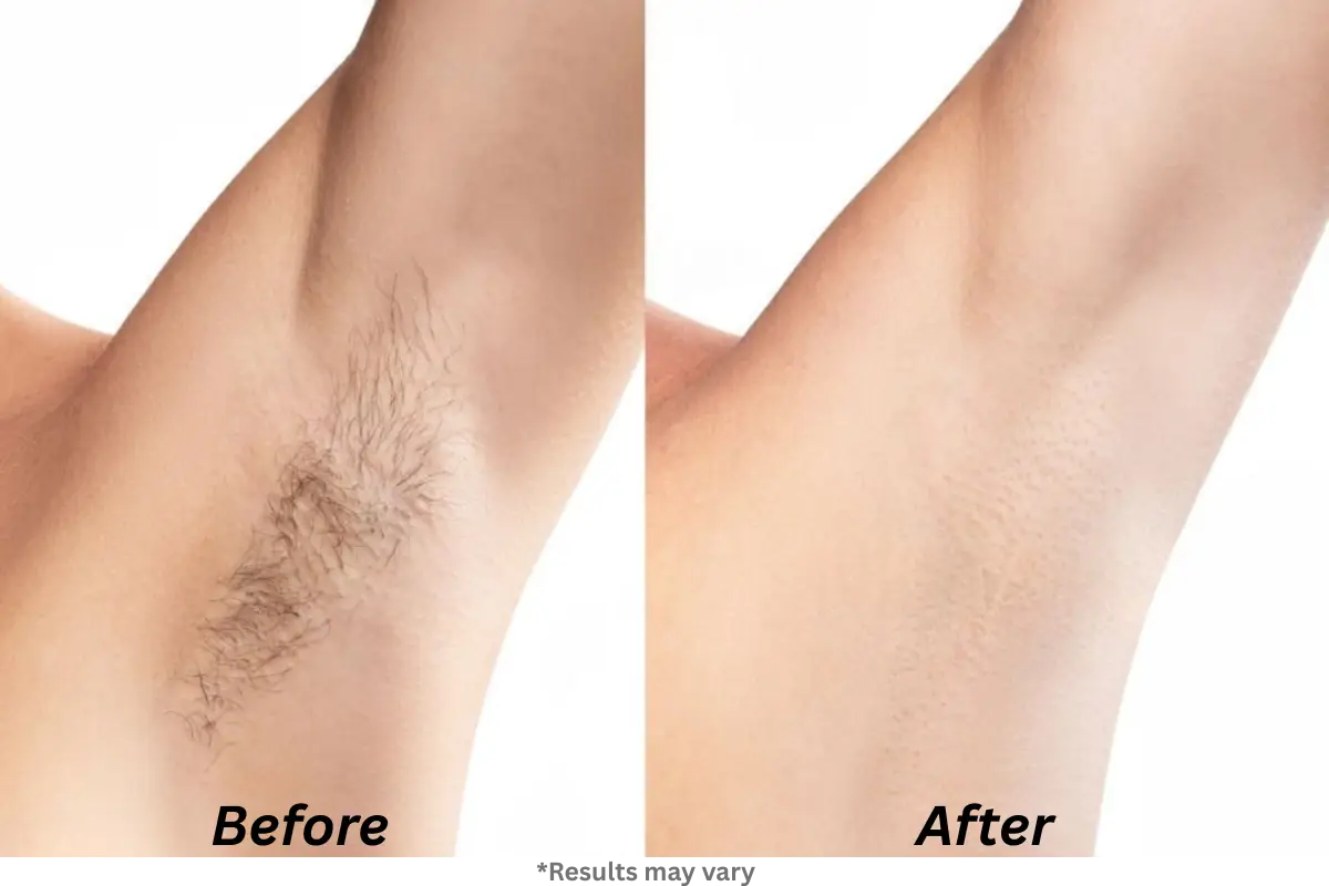 Imagine 30–90 Days From Now…